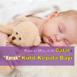 Punca Bayi Gatal Kulit Kepala