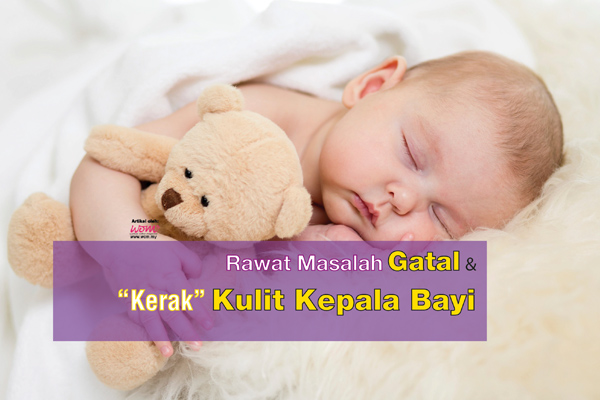 gatal kulit kepala - women online magazine