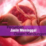 Punca-Punca Janin Meninggal Dalam Kandungan