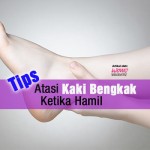 11 Tips Cegah Kaki Bengkak Ketika Hamil