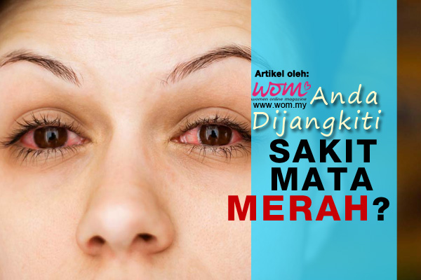 sakit mata merah - women online magazine